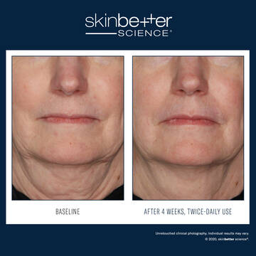 InterFuse Treatment Cream FACE & NECK
