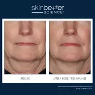 InterFuse Treatment Cream FACE & NECK