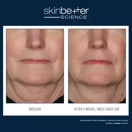 InterFuse Treatment Cream FACE & NECK