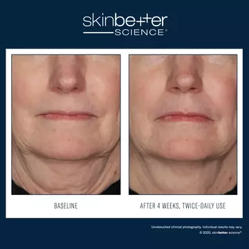 InterFuse Treatment Cream FACE & NECK