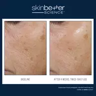 Trio Rebalancing Moisture Treatment
