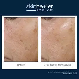 Trio Rebalancing Moisture Treatment