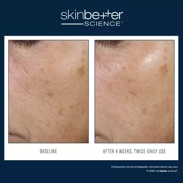 Trio Rebalancing Moisture Treatment