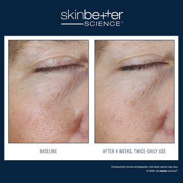 Instant Effect Gel EYE