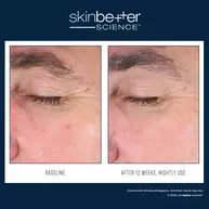  EyeMax AlphaRet Overnight Cream