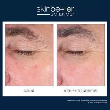  EyeMax AlphaRet Overnight Cream