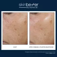 Trio Soin hydratant reequilibrant