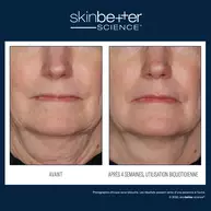 InterFuse Soin traitant​ VISAGE & COU