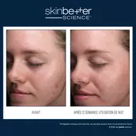  AlphaRet Serum clarifiant