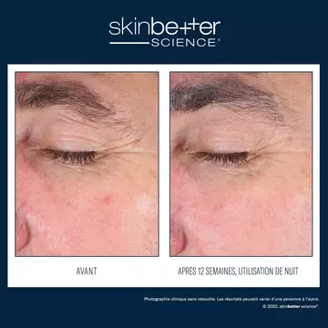  EyeMax AlphaRet Creme de nuit yeux