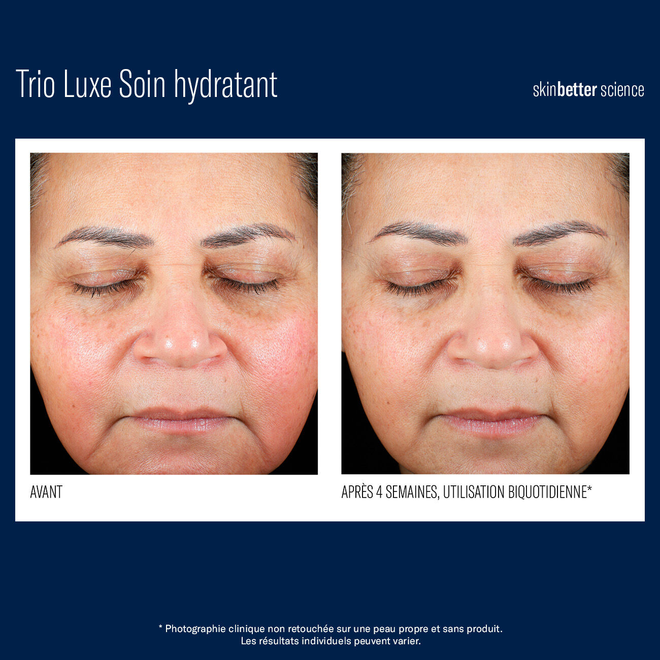 Trio Luxe Soin hydratant