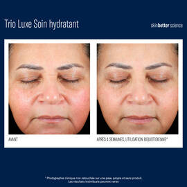 Trio Luxe Soin hydratant