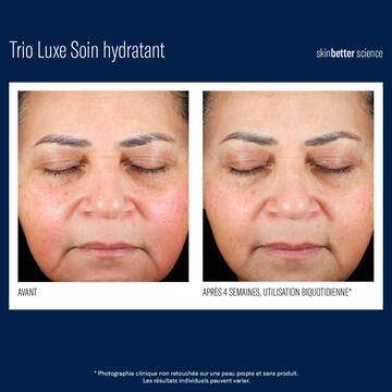 Trio Luxe Soin hydratant