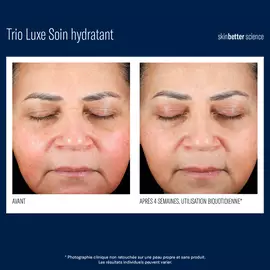 Trio Luxe Soin hydratant