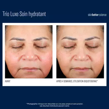 Trio Luxe Soin hydratant