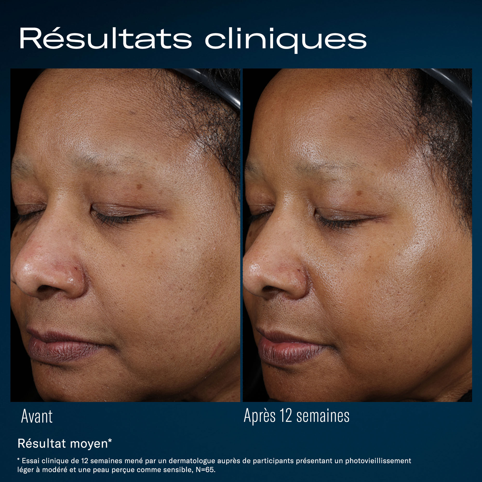 Ampra Serum volumateur Macro AH